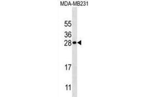 Western Blotting (WB) image for anti-Kallikrein 7 (KLK7) antibody (ABIN3002617) (Kallikrein 7 anticorps)
