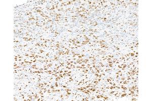 Immunohistochemistry (IHC) image for anti-Promyelocytic Leukemia (PML) (AA 375-425) antibody (ABIN7454722) (PML anticorps  (AA 375-425))