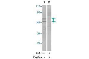 Western blot analysis of extracts from K-562 cells treated with H 2 O 2  (100 uM, 30 mins), using LYN polyclonal antibody . (CD180 anticorps)
