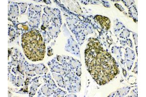 IHC analysis of HSPB8/Hsp22 using anti- HSPB8/Hsp22 antibody .