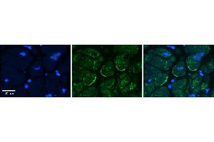 Rabbit Anti-ASPH Antibody    Formalin Fixed Paraffin Embedded Tissue: Human Adult heart  Observed Staining: Cytoplasmic, Membrane Primary Antibody Concentration: 1:600 Secondary Antibody: Donkey anti-Rabbit-Cy2/3 Secondary Antibody Concentration: 1:200 Magnification: 20X Exposure Time: 0.