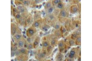 IHC-P analysis of Liver tissue, with DAB staining. (ALDH7A1 anticorps  (AA 29-539))