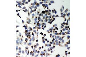 Anti-SQSTM1/p62 antibody, ICC ICC: Hela Cell