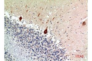 Immunohistochemical analysis of paraffin-embedded human-brain, antibody was diluted at 1:100 (Nodal anticorps  (C-Term))