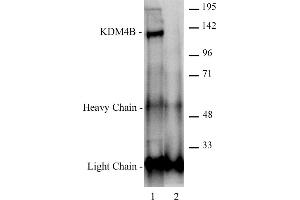 JMJD2B / KDM4B antibody (pAb) tested by Immunoprecipitation. (KDM4B anticorps  (C-Term))