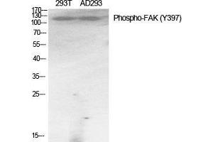 Western Blot (WB) analysis of specific cells using Phospho-FAK (Y397) Polyclonal Antibody. (FAK anticorps  (pTyr397))