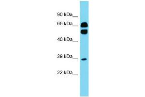 Host: Rabbit Target Name: CD200R1L Sample Type: Fetal Heart lysates Antibody Dilution: 1. (CD200R1L anticorps  (N-Term))
