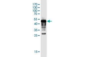 Western Blot detection against Immunogen (44. (FLJ35767 (AA 1-164) anticorps)