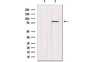 Western blot analysis of extracts from B16F10, using ABCD3 Antibody. (CX3CL1 anticorps  (C-Term))