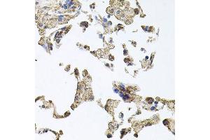 Immunohistochemistry of paraffin-embedded human lung using PKN1 antibody.