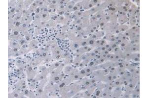 IHC-P analysis of Human Liver Tissue, with DAB staining. (AHNAK anticorps  (AA 1-300))