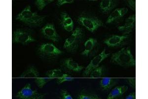 Immunofluorescence analysis of U-2 OS cells using Polyclonal AntibodyPC1 Polyclonal Antibody at dilution of 1:100 (40x lens). (PC1 anticorps)
