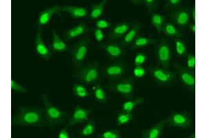 Immunofluorescence analysis of A549 cells using APTX antibody (ABIN5973100). (Aprataxin anticorps)