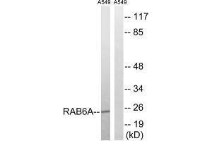 Western blot analysis of extracts from A549 cells, using RAB6A antibody. (RAB6A anticorps  (Internal Region))