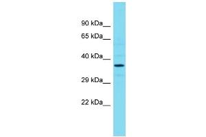 Host: Rabbit Target Name: ARHGEF39 Sample Type: RPMI-8226 Whole Cell lysates Antibody Dilution: 1.