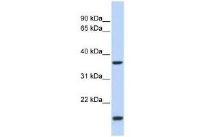 ZIC4 antibody used at 0. (ZIC4 anticorps  (N-Term))