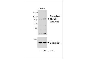 Western blot analysis of lysates from Hela cell line, untreated or treated with T, 200nM, using (ABIN6241062 and ABIN6578958) (upper) or Beta-actin (lower).