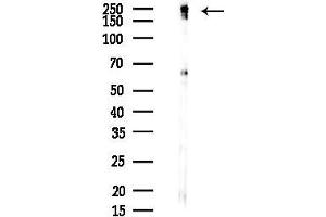 anti-Multiple PDZ Domain Protein (MPDZ) (C-Term) antibody