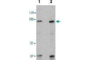 Western blot analysis of SKI in human kidney tissue lysate with SKI polyclonal antibody  at 1 and 2 ug/mL . (SKI anticorps  (N-Term))