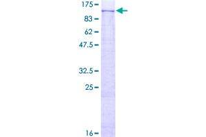 Image no. 1 for Phospholipase D2 (PLD2) (AA 1-933) protein (GST tag) (ABIN1315349)