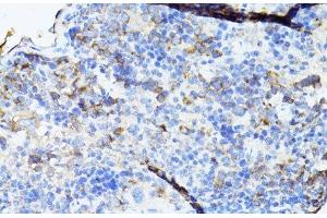 Immunohistochemistry of paraffin-embedded Mouse spleen using TEFM Polyclonal Antibody at dilution of 1:100 (40x lens). (TEFM anticorps)