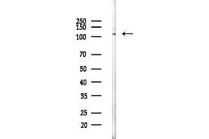 anti-Complement Component 6 (C6) antibody