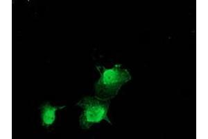 Anti-ZFAND2B mouse monoclonal antibody (ABIN2454250) immunofluorescent staining of COS7 cells transiently transfected by pCMV6-ENTRY ZFAND2B (RC203822). (ZFAND2B anticorps)