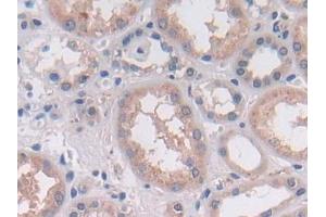 DAB staining on IHC-P; Samples: Human Kidney Tissue (OAS2 anticorps  (AA 11-346))