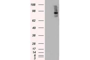 Image no. 4 for anti-B-Raf proto-oncogene, serine/threonine kinase (BRAF) antibody (ABIN1496954) (BRAF anticorps)