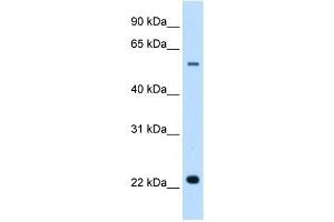 SLC17A5 antibody used at 0.