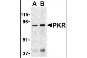 Western blot analysis of PKR in Caco-2 whole cell lysate with this product at (A) 1 and (B) 2 μg/ml. (EIF2AK2 anticorps  (N-Term))