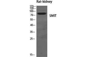 Western Blot (WB) analysis of specific cells using SMIT Polyclonal Antibody. (SLC5A3 anticorps  (Internal Region))