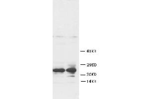 Anti-FGF8 antibody, Western blottingWB: Rat Ovary Tissue Lysate (FGF8 anticorps  (C-Term))