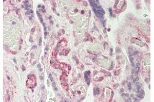 Rabbit Anti-RAPGEF1 antibody Catalog Number: ARP54753 Formalin Fixed Paraffin Embedded Tissue: Human Placenta Primary antibody Concentration: 1:100 Secondary Antibody: Donkey anti-Rabbit-Cy3 Secondary Antibody Concentration: 1:200 Magnification: 20x Exposure Time: 0.