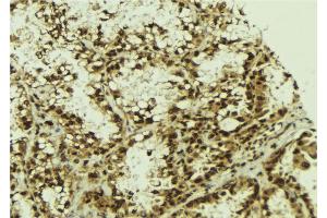 ABIN6273273 at 1/100 staining Human lung tissue by IHC-P. (NFKBIZ anticorps  (Internal Region))