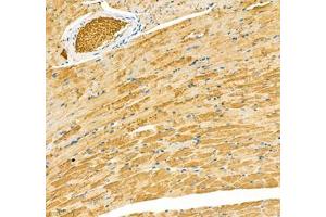 Immunohistochemistry of paraffin embedded mouse heart using Sarcomeric α Actinin (ABIN7075510) at dilution of 1: 1000 (200x lens) (Sarcomeric alpha Actinin anticorps)