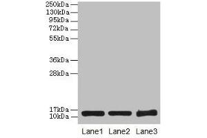 Western blot All lanes: SNCG antibody at 16 μg/mL Lane 1: HT29 whole cell lysate Lane 2: Mouse brain tissue Lane 3: 293T whole cell lysate Secondary Goat polyclonal to rabbit IgG at 1/10000 dilution Predicted band size: 14 kDa Observed band size: 14 kDa