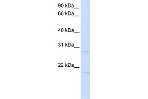WB Suggested Anti-TCF21 Antibody Titration:  0. (TCF21 anticorps  (C-Term))