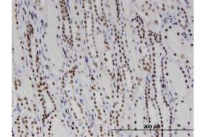 Image no. 1 for anti-DEAD/H (Asp-Glu-Ala-Asp/His) Box Polypeptide 11 (DDX11) (AA 1-970) antibody (ABIN599369) (DDX11 anticorps  (AA 1-970))