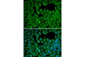 Immunofluorescence analysis of HeLa cells using NET1 antibody (ABIN5970555). (NET1 anticorps)