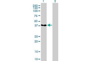 Western Blot analysis of PCBP2 expression in transfected 293T cell line by PCBP2 monoclonal antibody (M07), clone 5F12.