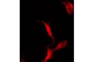 ABIN6272291 staining COLO205 by IF/ICC. (KIF11 anticorps  (C-Term))