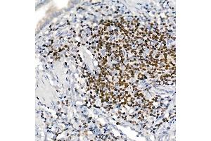 Immunohistochemistry of paraffin-embedded rat lung using IKZF3 antibody (ABIN7267842) at dilution of 1:100 (40x lens).