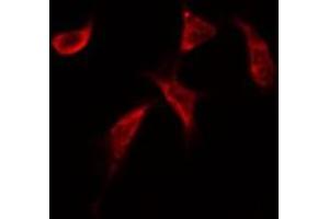 ABIN6269152 staining Hela by IF/ICC.