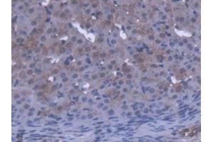 DAB staining on IHC-P; Samples: Mouse Ovary Tissue (OVGP1 anticorps  (AA 231-476))
