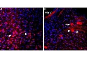 Expression of MCT2 in mouse brain sections - Immunohistochemical staining of perfusion-fixed frozen mouse brain sections using Anti-MCT2 Antibody (ABIN7043678, ABIN7044616 and ABIN7044617), (1:1000).