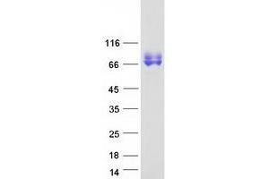 Validation with Western Blot