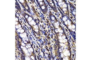 Immunohistochemistry of paraffin-embedded rat ileum using ARID3A antibody (ABIN5975618) at dilution of 1/100 (40x lens). (ARID3A anticorps)