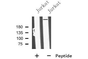 Western blot analysis of MIA3 using Jurkat whole cell lysates (MIA3 anticorps  (C-Term))