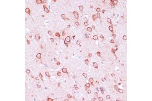 Immunohistochemistry of paraffin-embedded rat brain using RPL21 antibody (ABIN7269996) at dilution of 1:100 (40x lens).